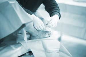 Recovering From Ankle Arthroscopy