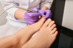 Is Laser Treatment Effective for Toenail Fungus?