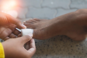 Caring for Foot Blisters