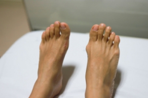 Tending to Bunions