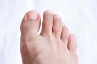 Signs You May Have an Ingrown Toenail